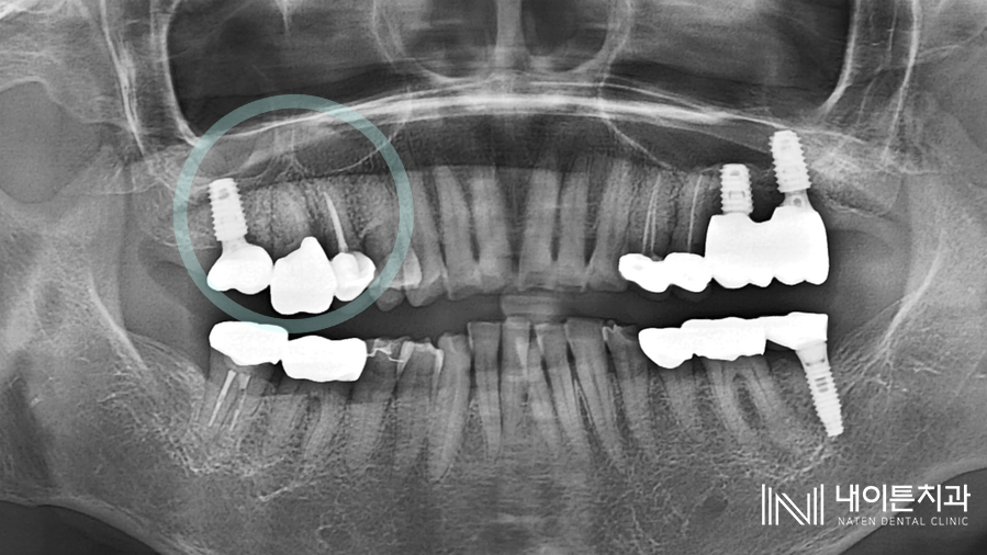 Treatment case image 1