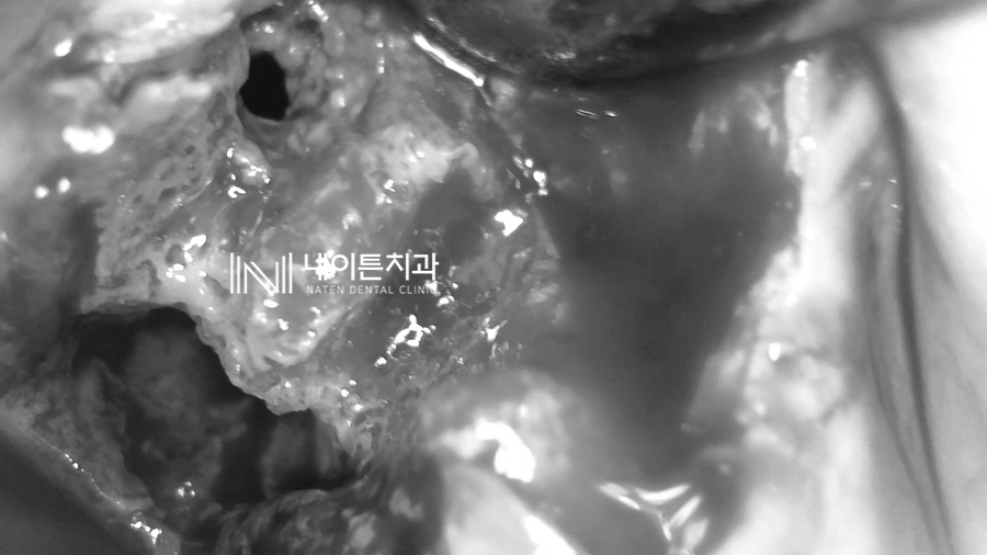 Treatment case image 5