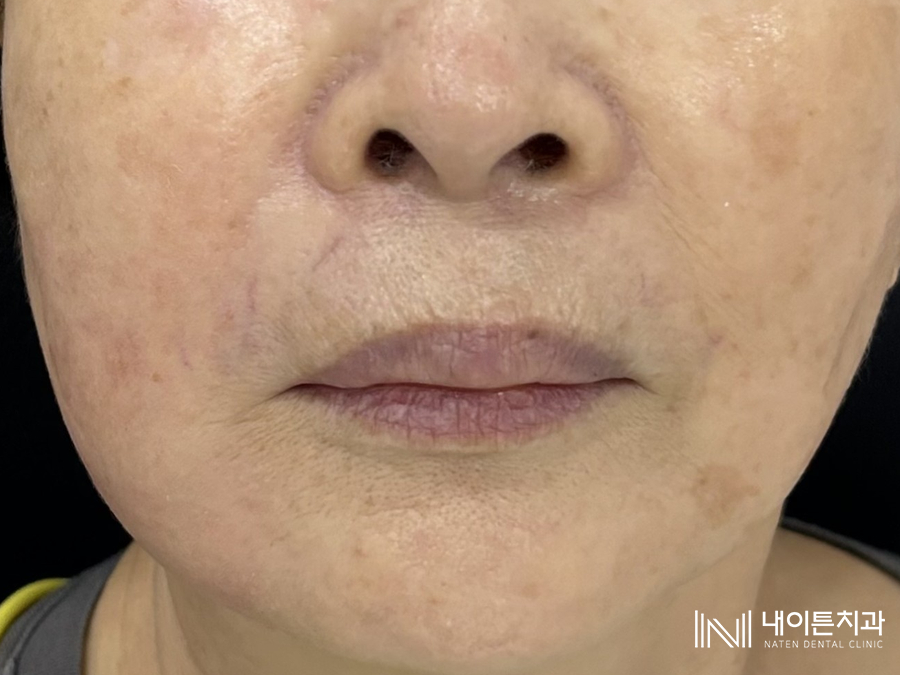 Treatment case image 6