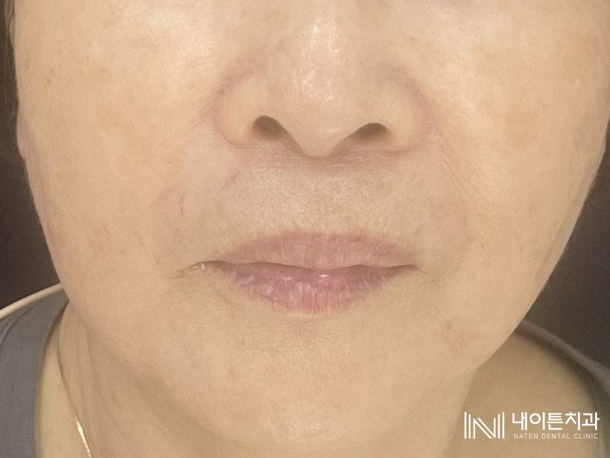 Treatment case image 7
