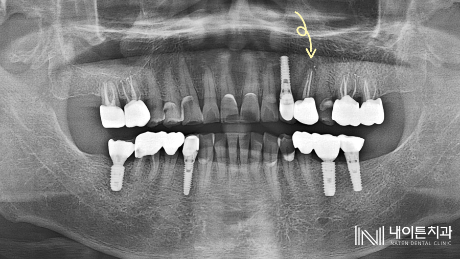 Treatment case image 1