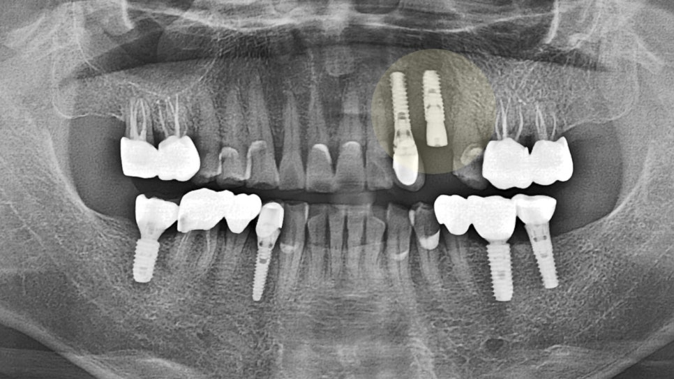 Treatment case image 4