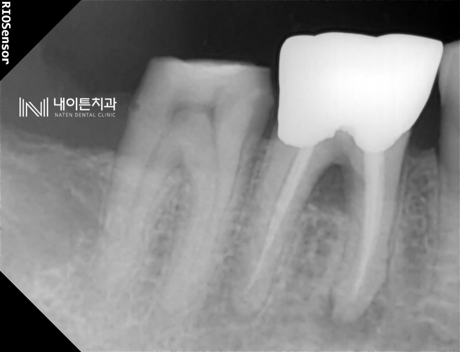 Treatment case image 6