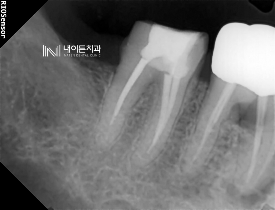Treatment case image 7