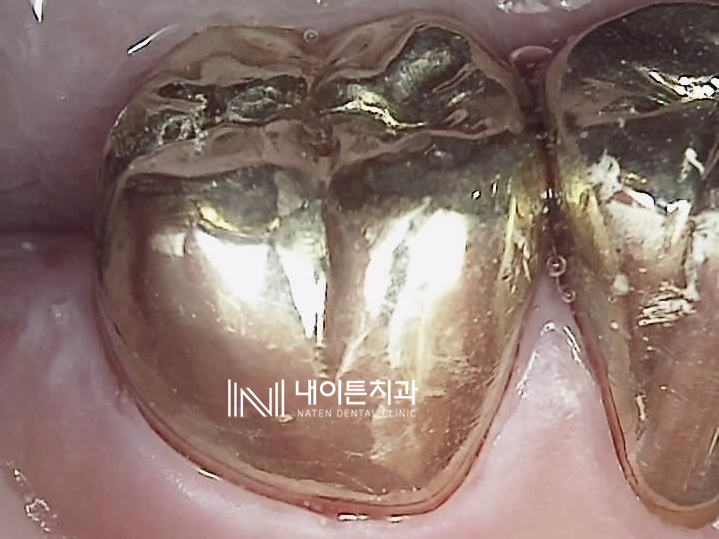 Treatment case image 8