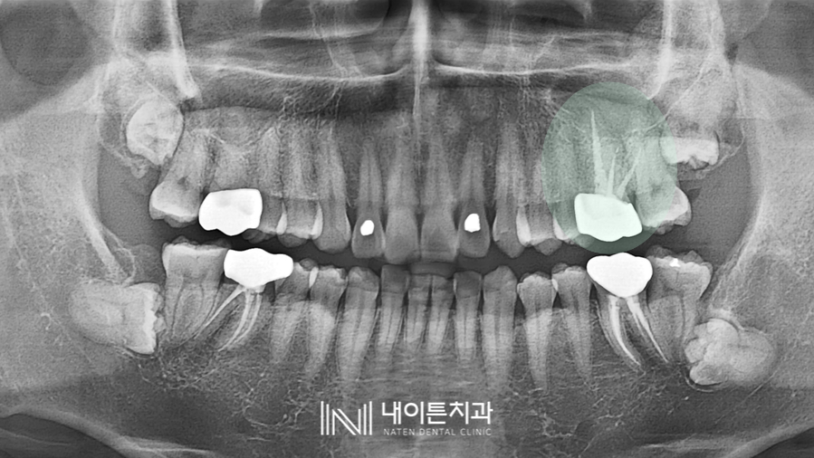 Treatment case image 1