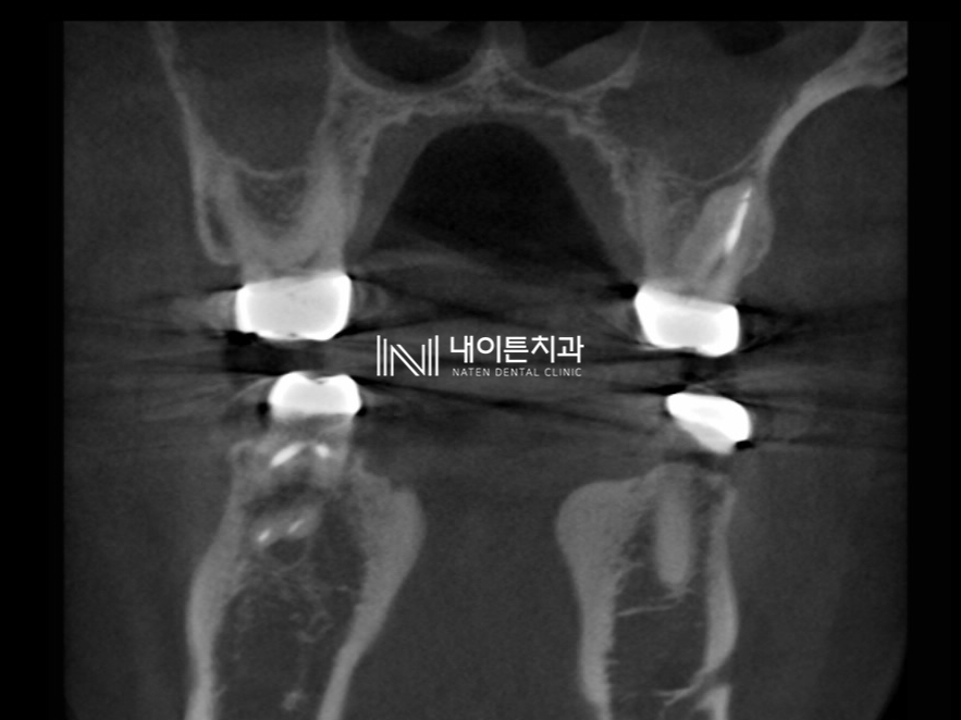 Treatment case image 3