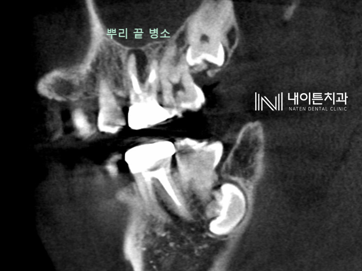 Treatment case image 4