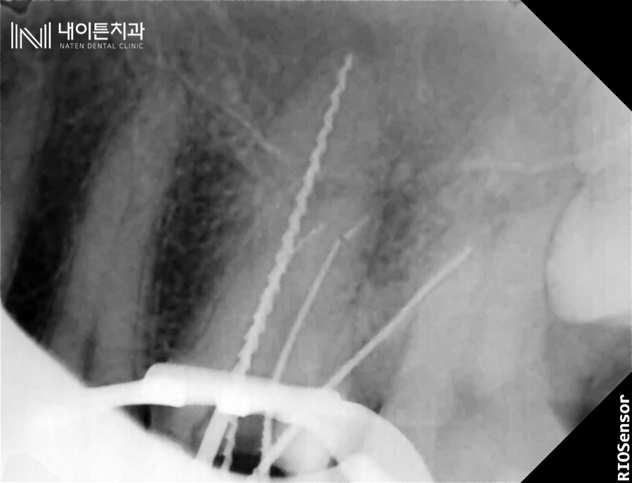 Treatment case image 9