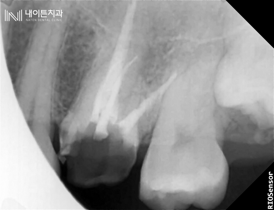 Treatment case image 10
