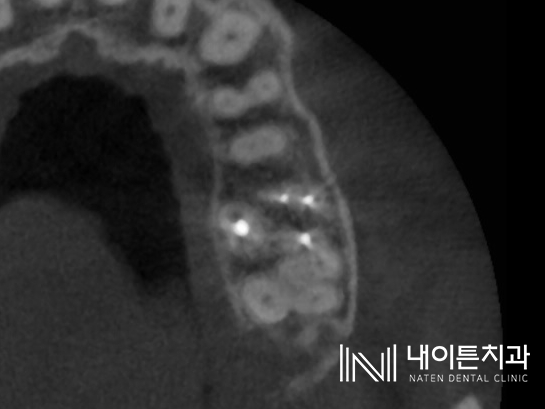 Treatment case image 12
