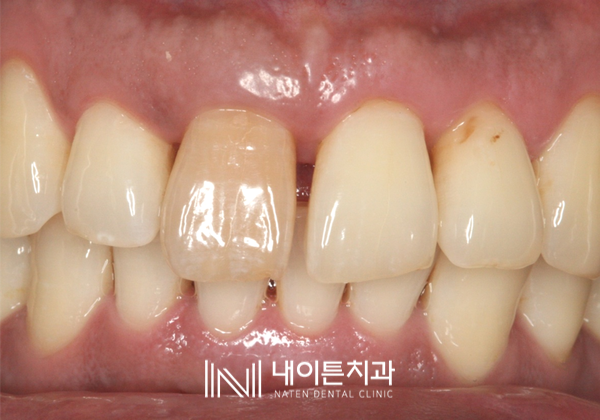 Treatment case image 1