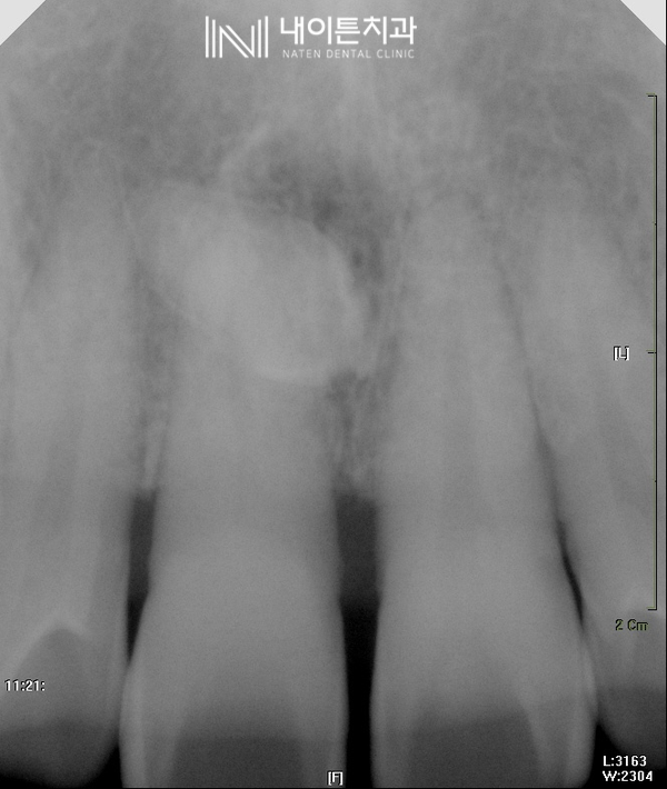 Treatment case image 2