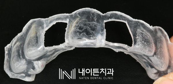 Treatment case image 5
