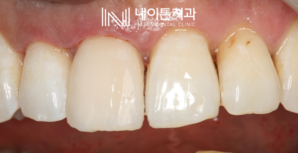 Treatment case image 19