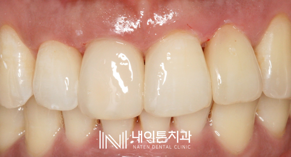 Treatment case image 21