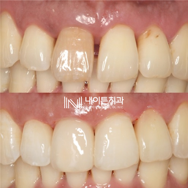 Treatment case image 22