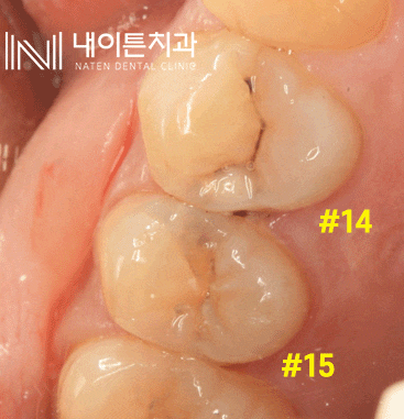 Treatment case image 1