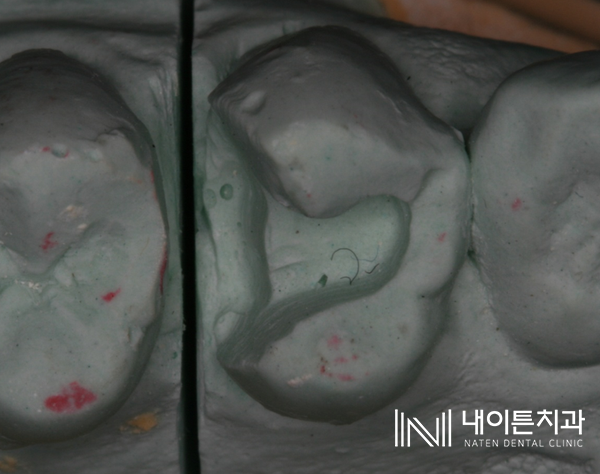 Treatment case image 2