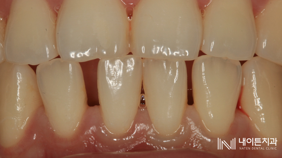 Treatment case image 1