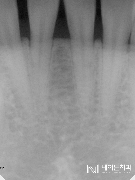 Treatment case image 2