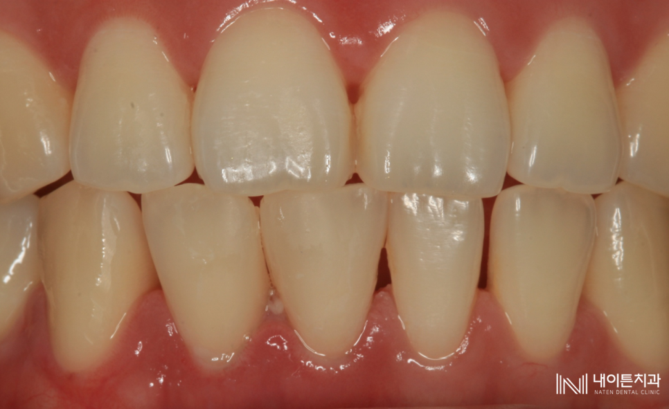 Treatment case image 3