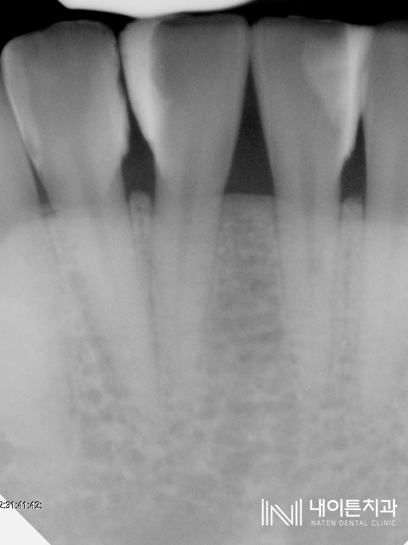 Treatment case image 7