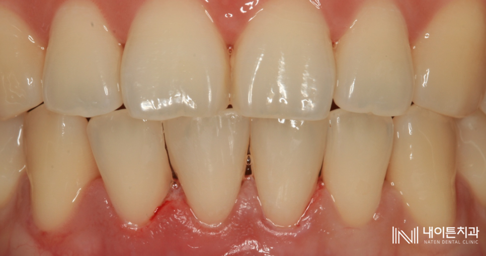 Treatment case image 8