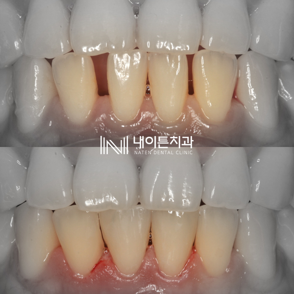 Treatment case image 10