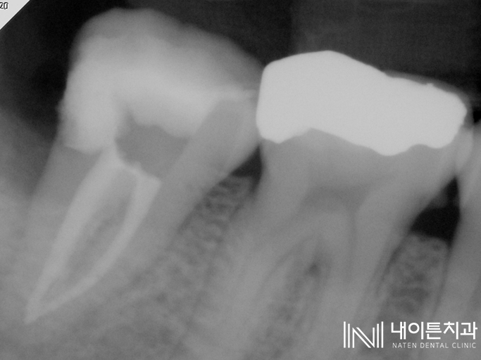 Treatment case image 9