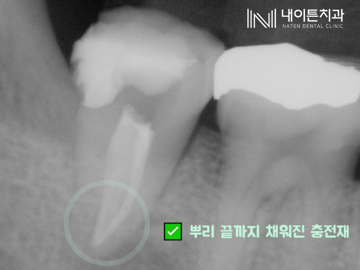 Treatment case image 10