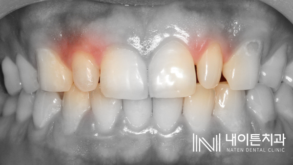 Treatment case image 1