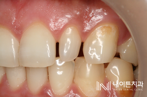 Treatment case image 3