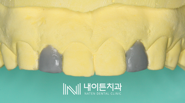 Treatment case image 7