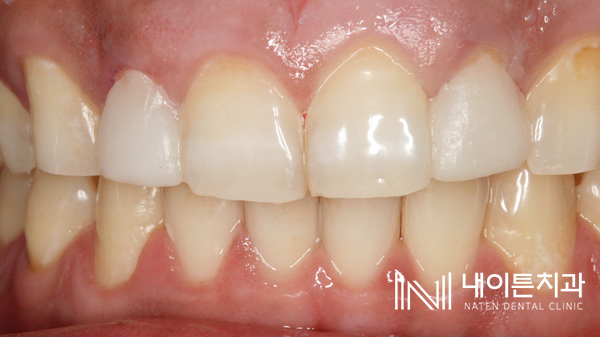 Treatment case image 15