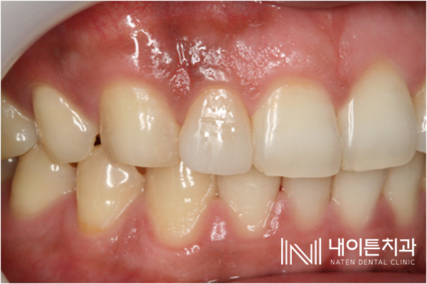 Treatment case image 16