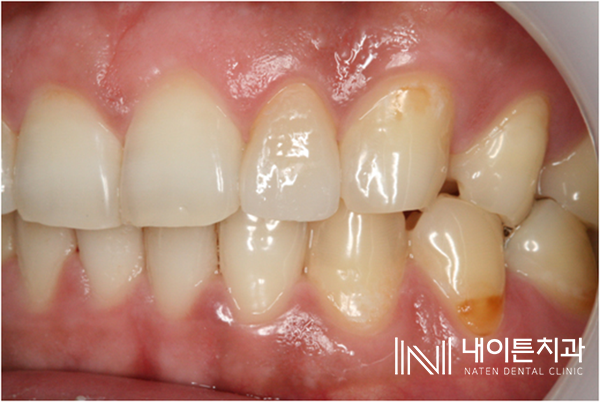 Treatment case image 17