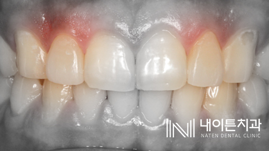 Treatment case image 18