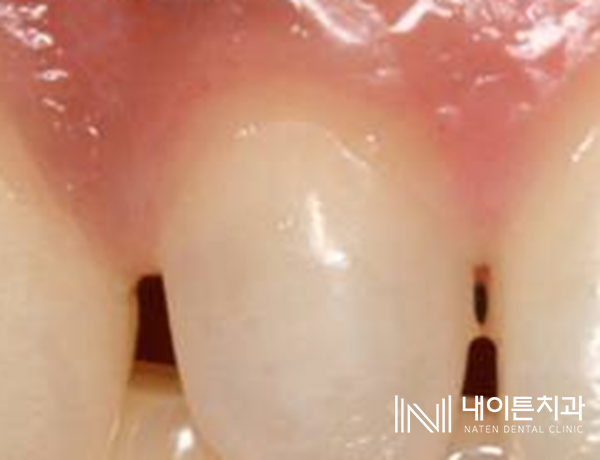 Treatment case image 19