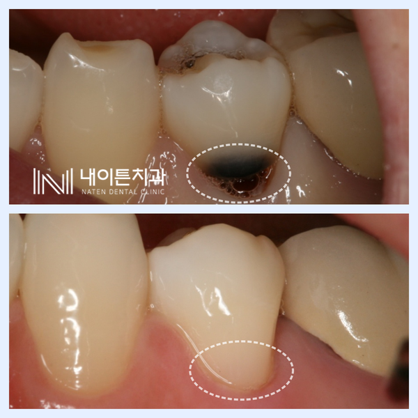 Treatment case image 2