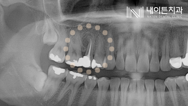 Treatment case image 1