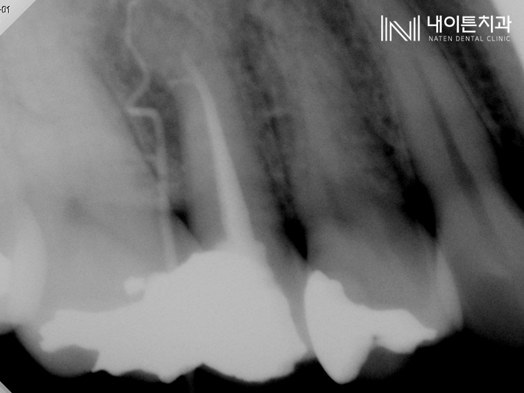 Treatment case image 2