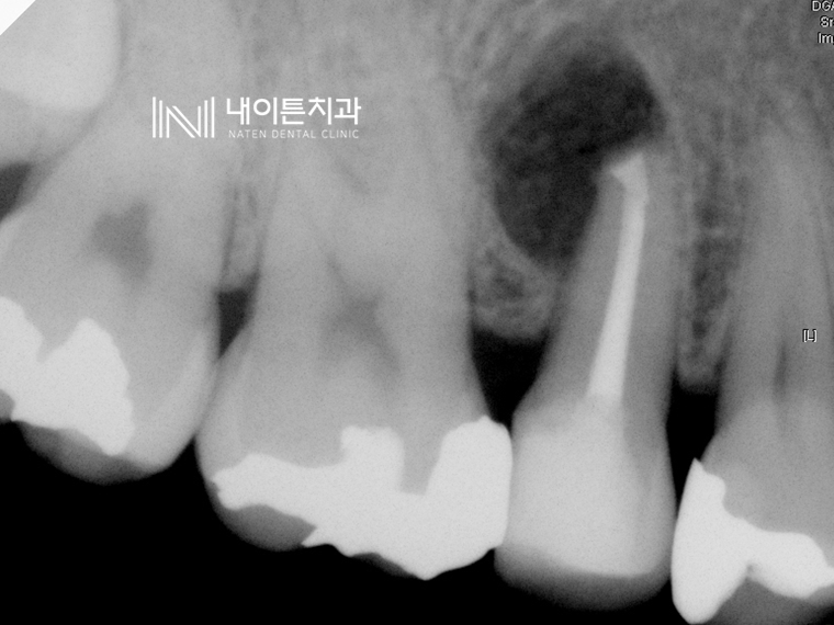 Treatment case image 5