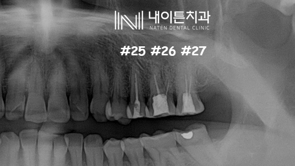 Treatment case image 1