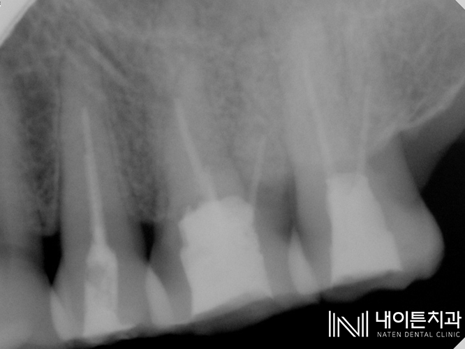 Treatment case image 3