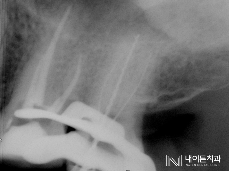 Treatment case image 6