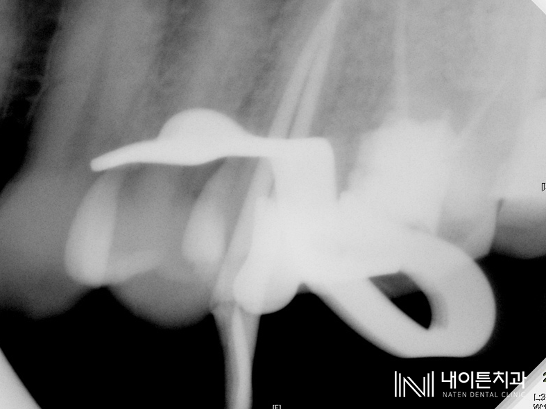 Treatment case image 7