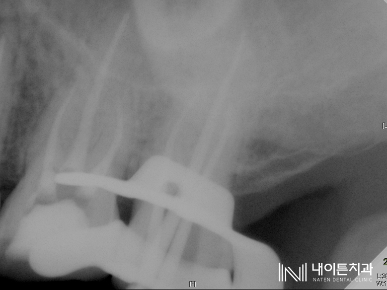 Treatment case image 9