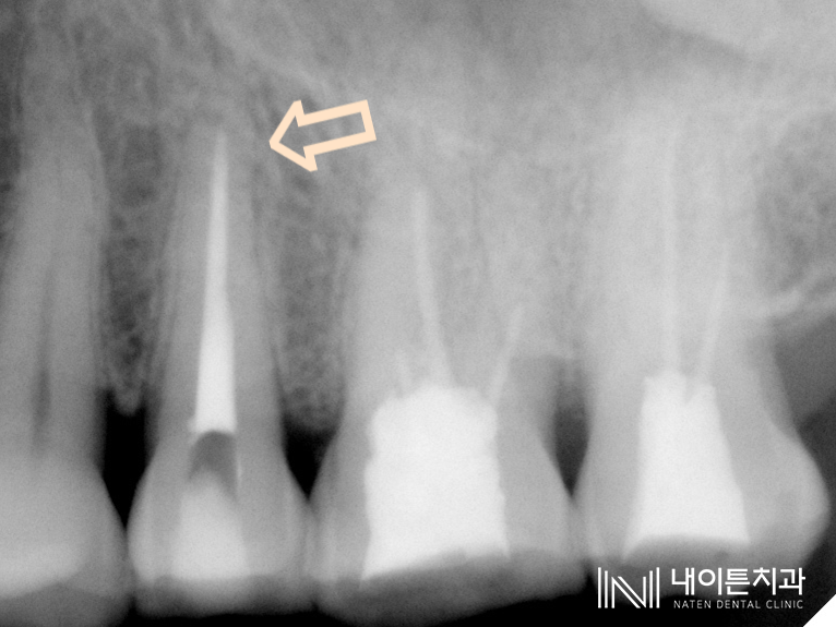 Treatment case image 10