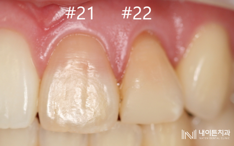 Treatment case image 1